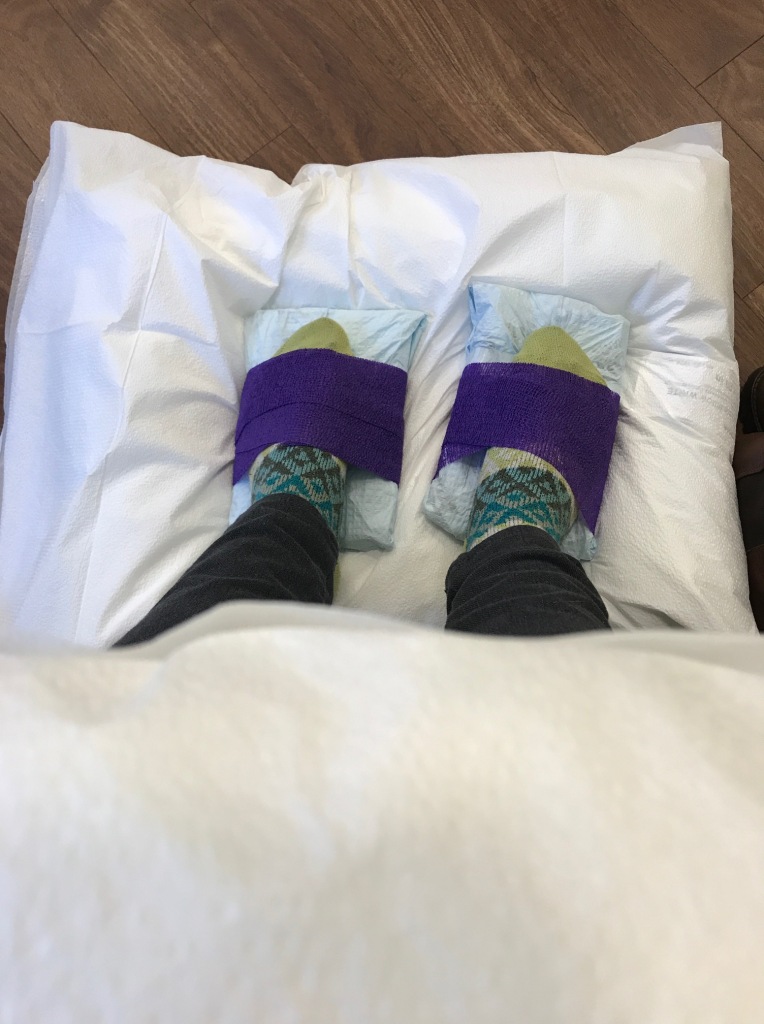 Top-down view of two socked feet  strapped onto ice packs with purple stretchy tape.